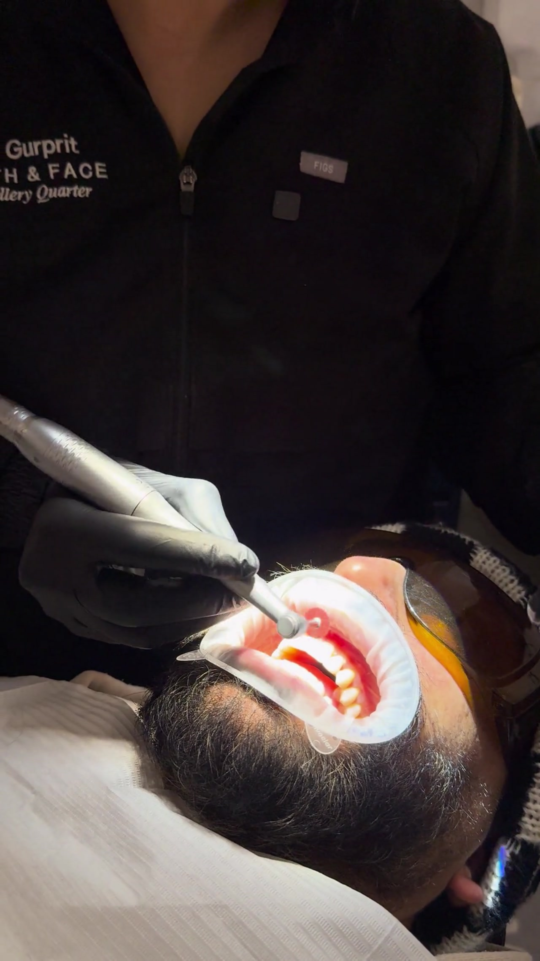 Composite Bonding at Teeth & Face Birmingham Composite Bonding at Teeth & Face Birmingham